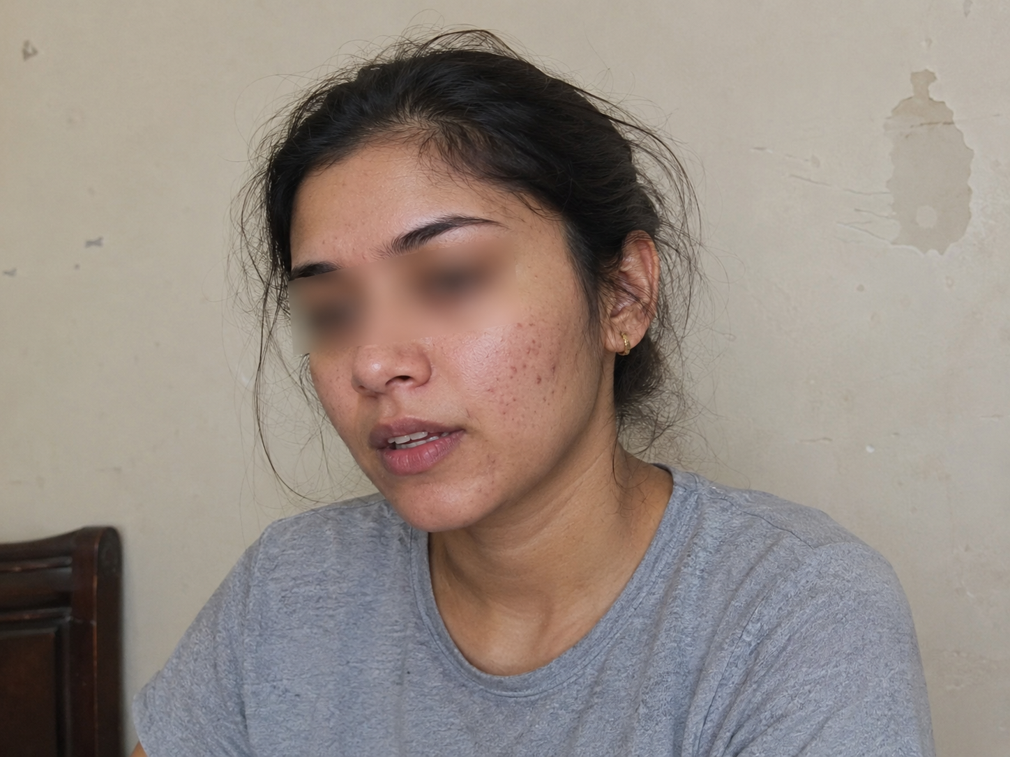 Skin Health Testimonial